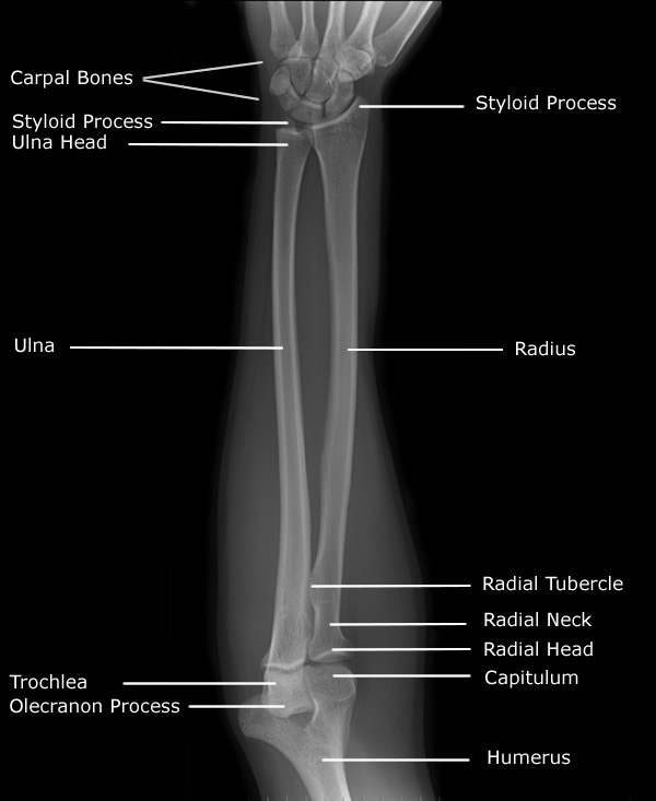 Ce Rt Radiographic Positioning Of The Elbow For X Ray Technicians