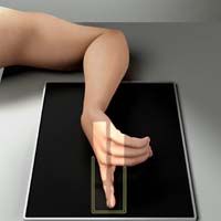 Lateral Finger X-Ray position
