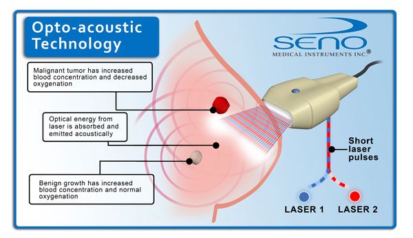 Schematic representation of opto-acoustic breast imaging