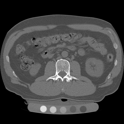 Bone Density Evaluation (DEXA) - Patient Services - Assured Imaging