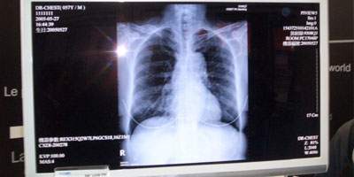 CE4RT - PACS and DICOM Resources for Radiologic Technologists