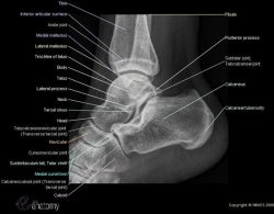 CE4RT - Radiographic Positioning of the Heel and Ankle for X-ray Techs