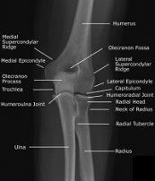 CE4RT - Radiographic Positioning of the Elbow for X-ray Technicians