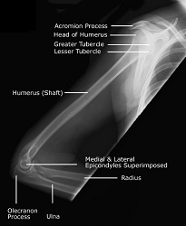 CE4RT - Radiographic Positioning of the Shoulder for X-ray Techs