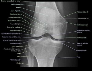 Radiographic Positioning Examples Of The Leg And Knee CE RT