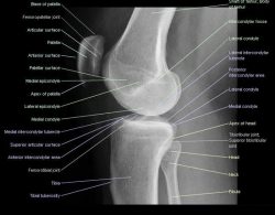 Radiographic Positioning Examples of the Leg and Knee - CE4RT