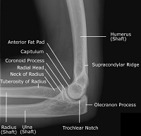 CE4RT - Radiographic Positioning of the Elbow for X-ray Technicians