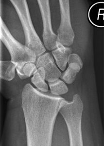 CE4RT - Radiographic Positioning of the Wrist for X-ray Technologists