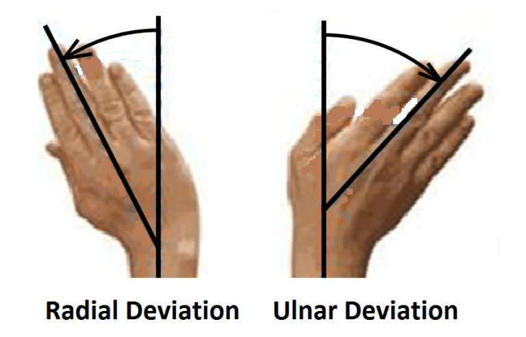 CE4RT - Radiographic Positioning of the Wrist for X-ray Technologists