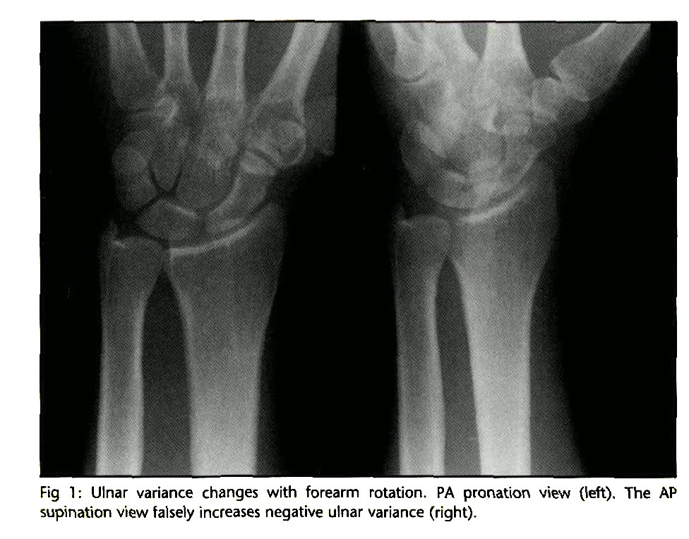 CE4RT - Radiographic Positioning of the Wrist for X-ray Technologists