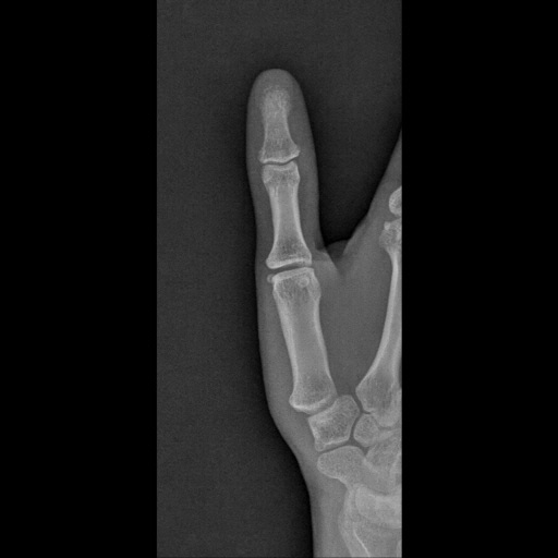 CE4RT - Radiographic Positioning of the Hand and Fingers for X-ray Techs