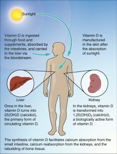 rickets and osteomalacia causes lack of sunlight exposure