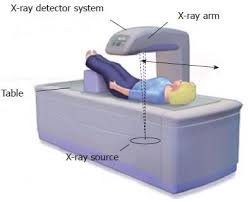 DXA scan analysis