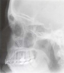 CE4RT - Radiographic Positioning Face and Mandible for X-ray Techs