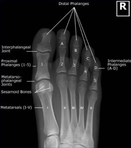 CE4RT - Radiographic Positioning Of The Toes - A Guide For X-ray Techs