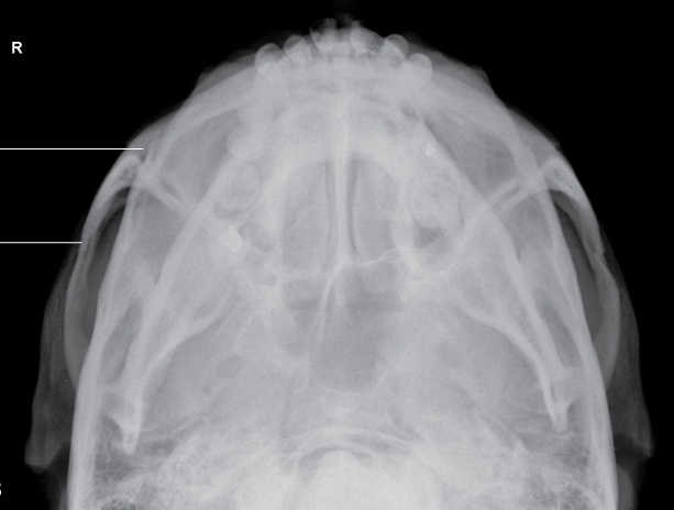 Zygomatic Arch - X-ray Tech Positioning Guide